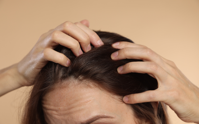 Combat Hair Loss in Dubai: Is Mesotherapy the Solution?
